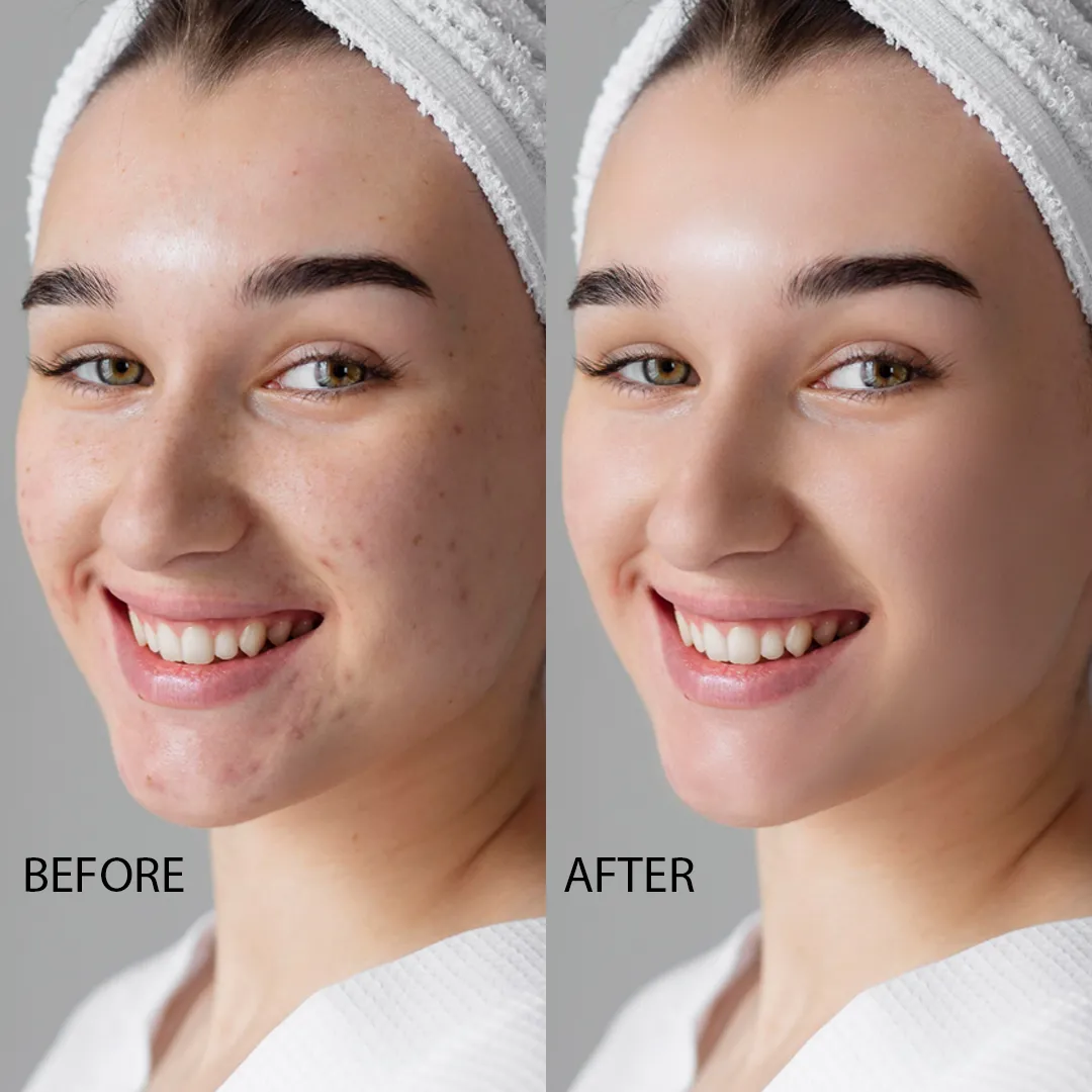 Retouching